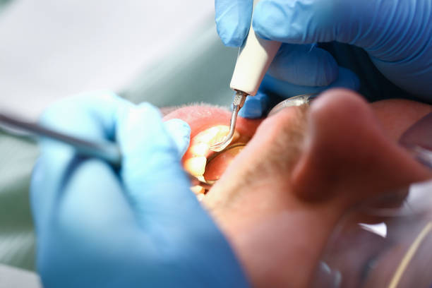 Best Emergency Dentist for Knocked-Out Tooth in Lawrenceville, VA