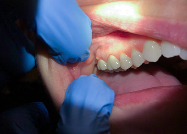 Best Emergency Dentist for Special Needs Patients in Lawrenceville, VA