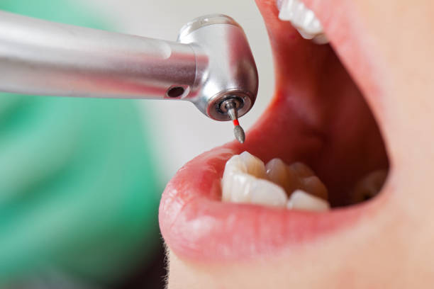 Best Weekend Emergency Dentist in Lawrenceville, VA